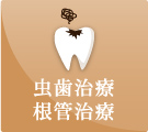 虫歯治療根管治療